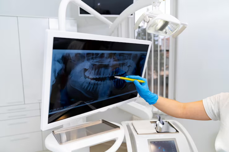 Digital X-Rays & OPG