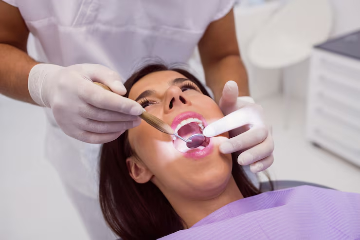 Fluoride Treatment