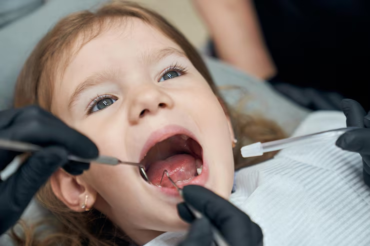 Kids Root Canal & Crowns