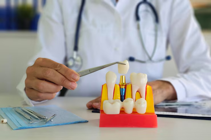 Root Canal Re-treatment